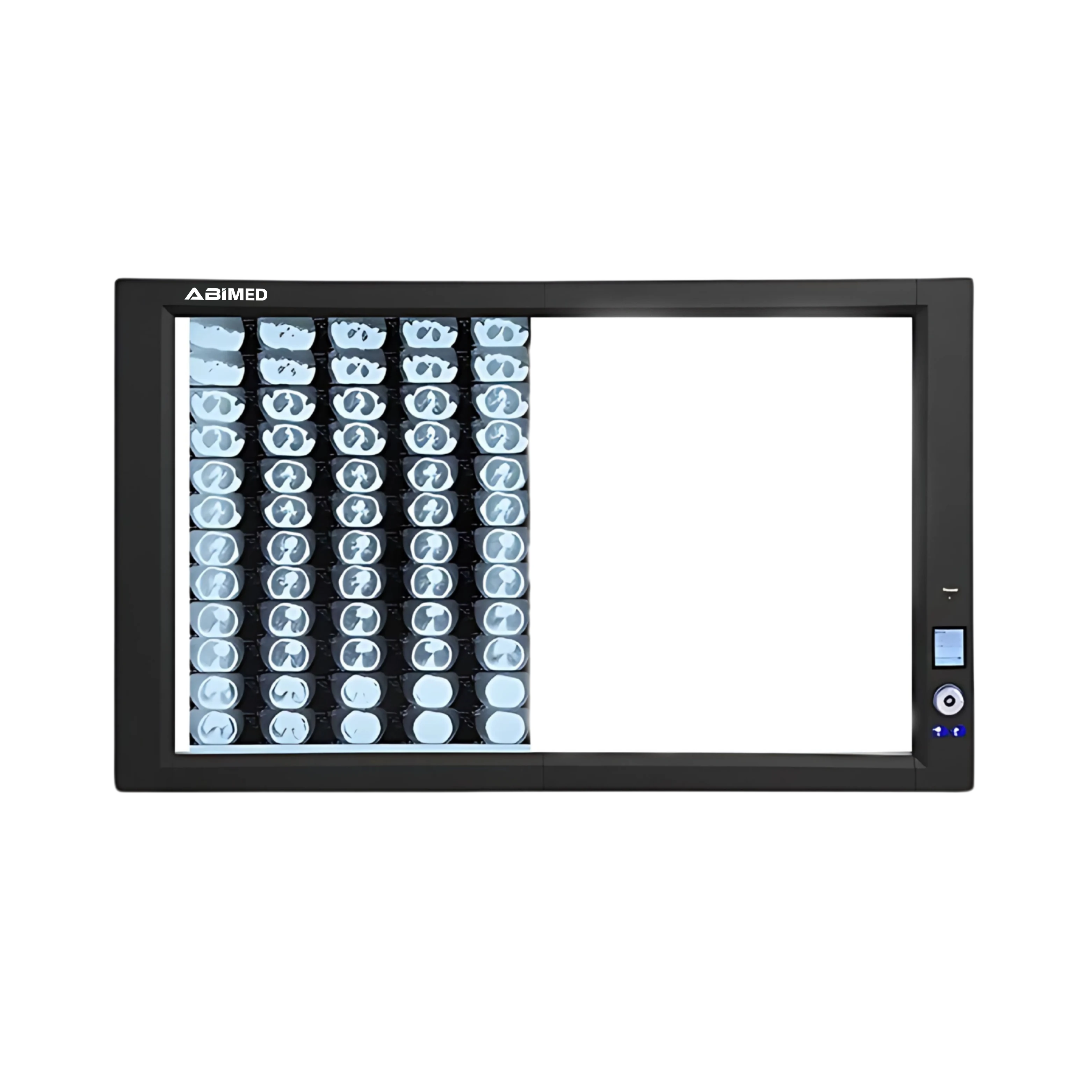 Ultra-Slim X-RAY Film Viewer AM-ULX-RAYA11D