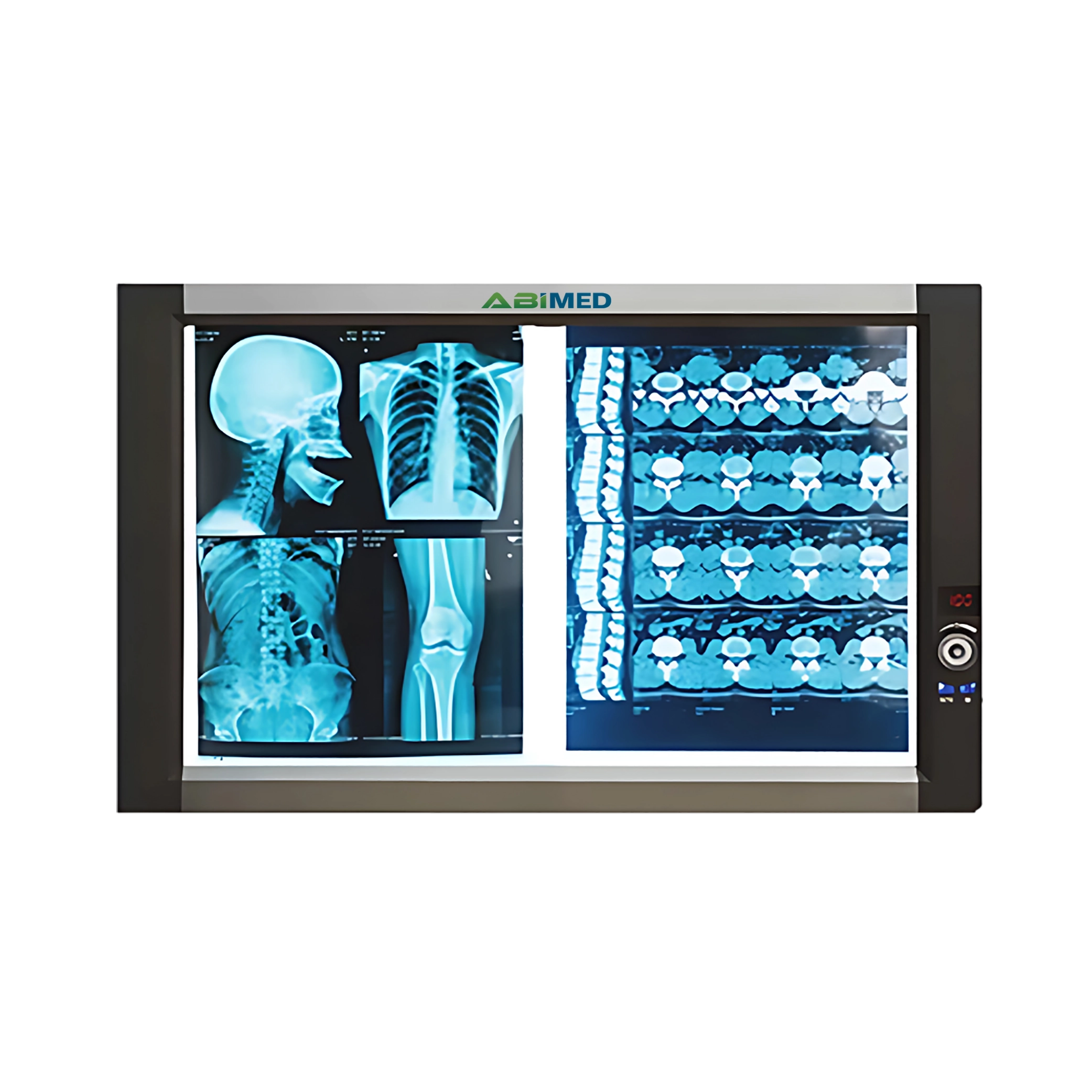 Ultra-Slim X-RAY Film Viewer AM-ULX-RAYB11D