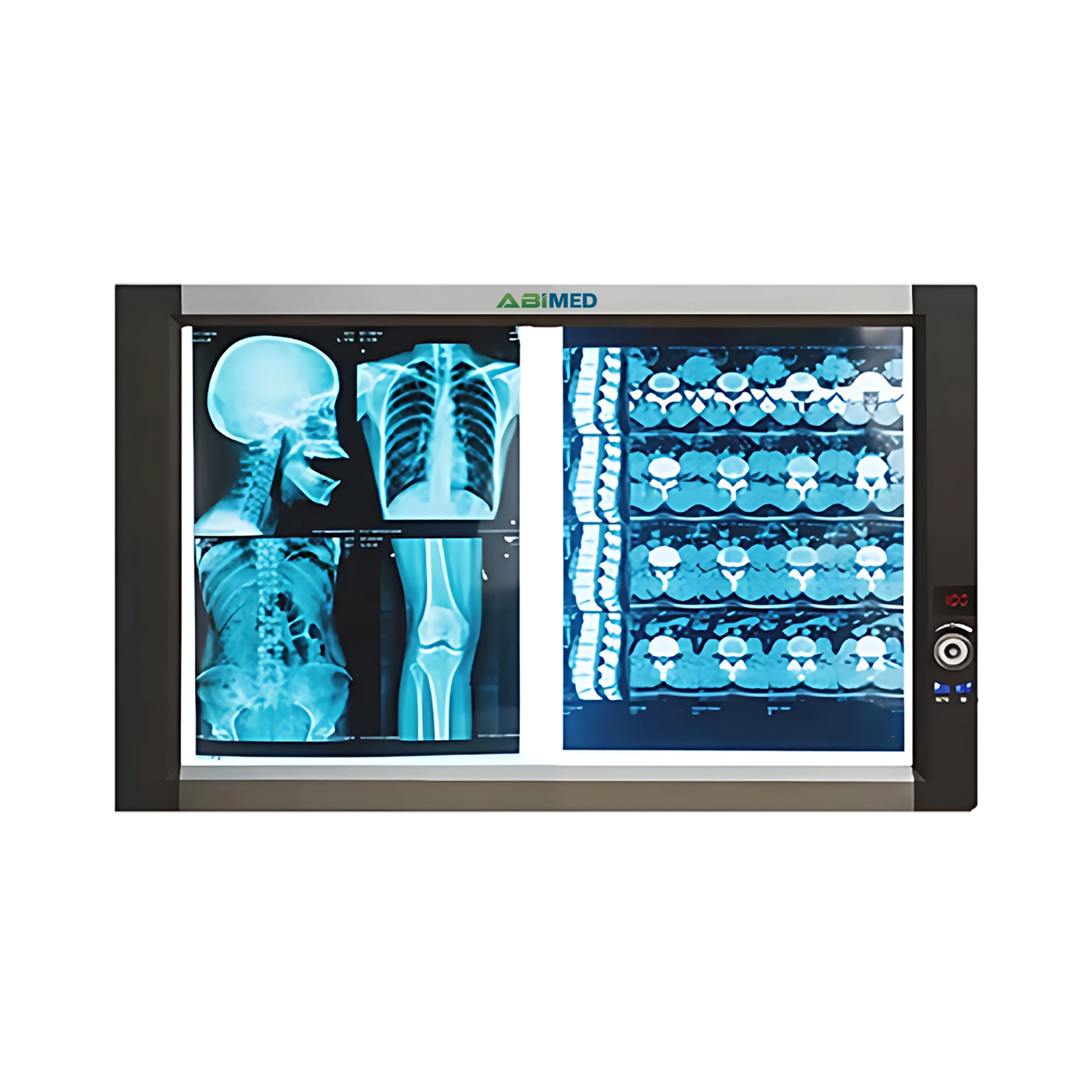 Ultra-Slim X-RAY Film Viewer AM-ULX-RAYC11D