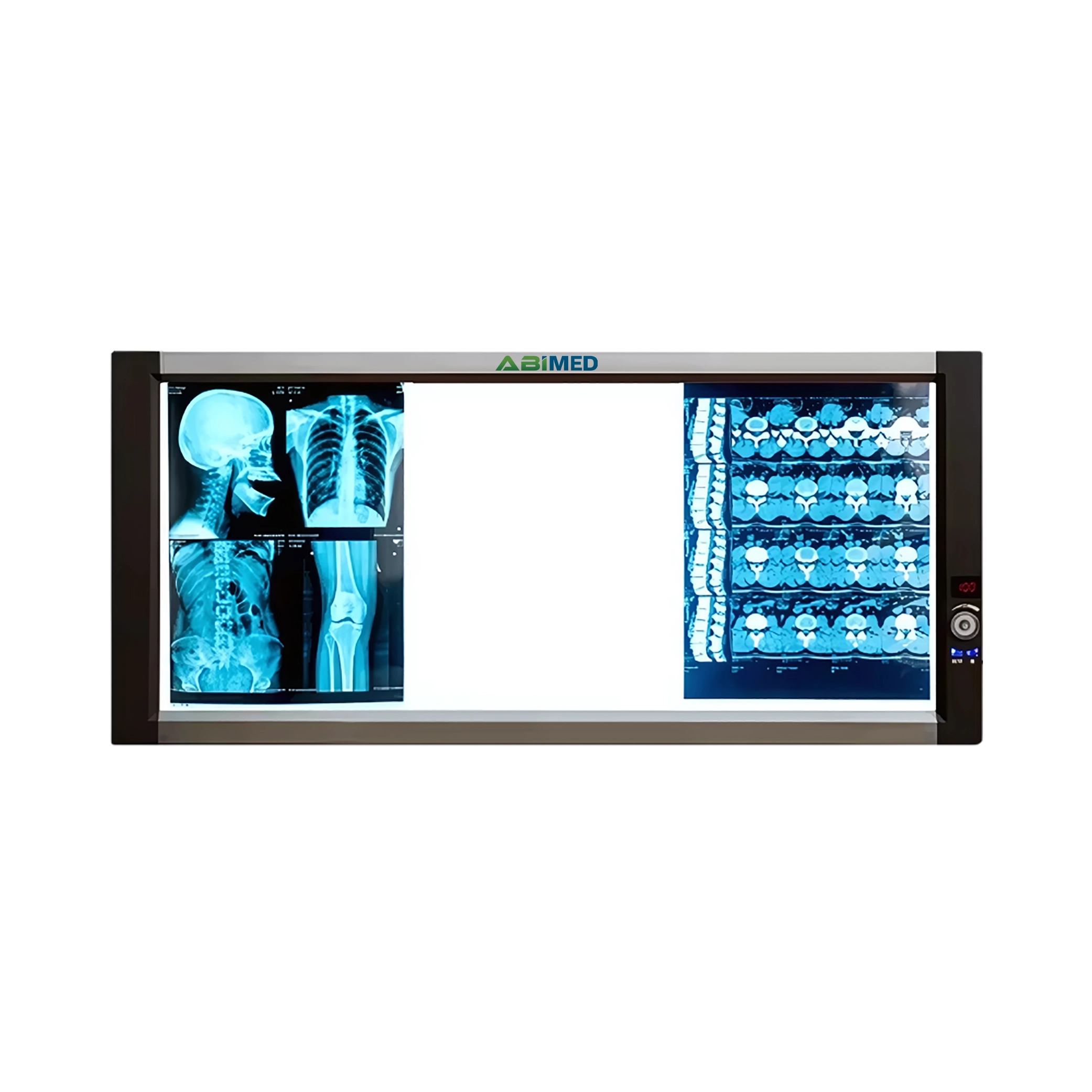 Ultra-Slim X-RAY Film Viewer AM-ULX-RAYC12T