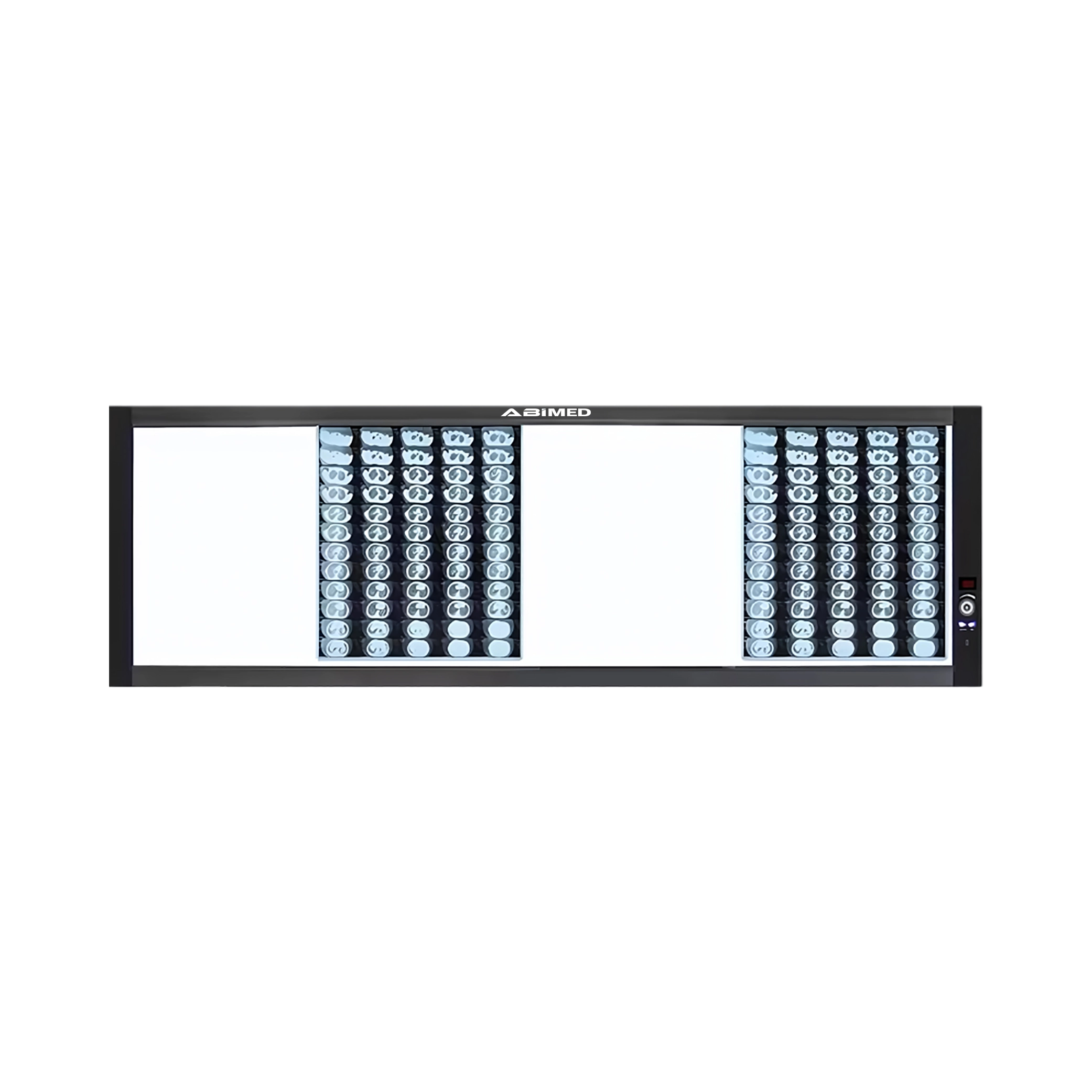Ultra-Slim X-RAY Film Viewer AM-ULX-RAYC13Q
