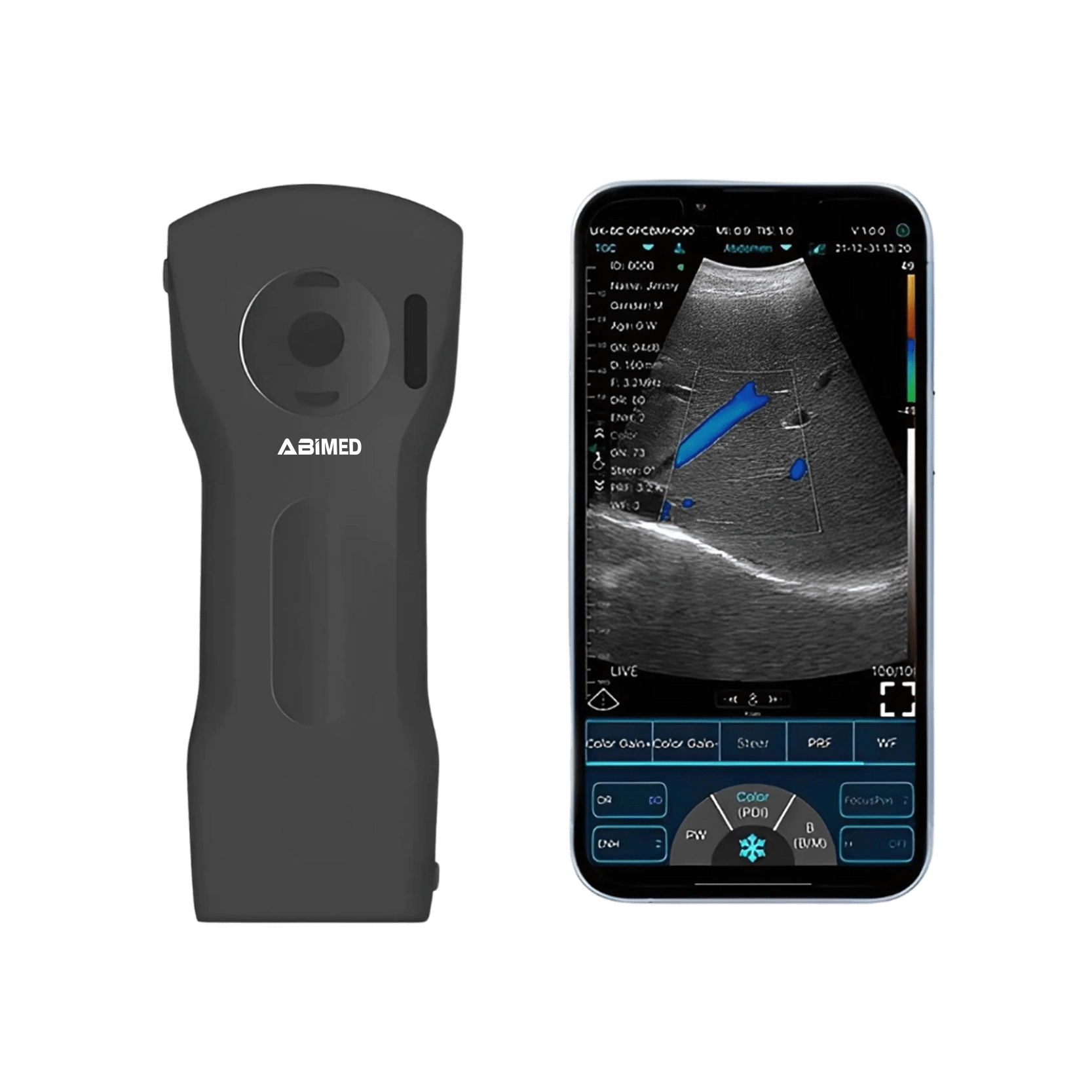 Ultrasound Scanner AM-USA14
