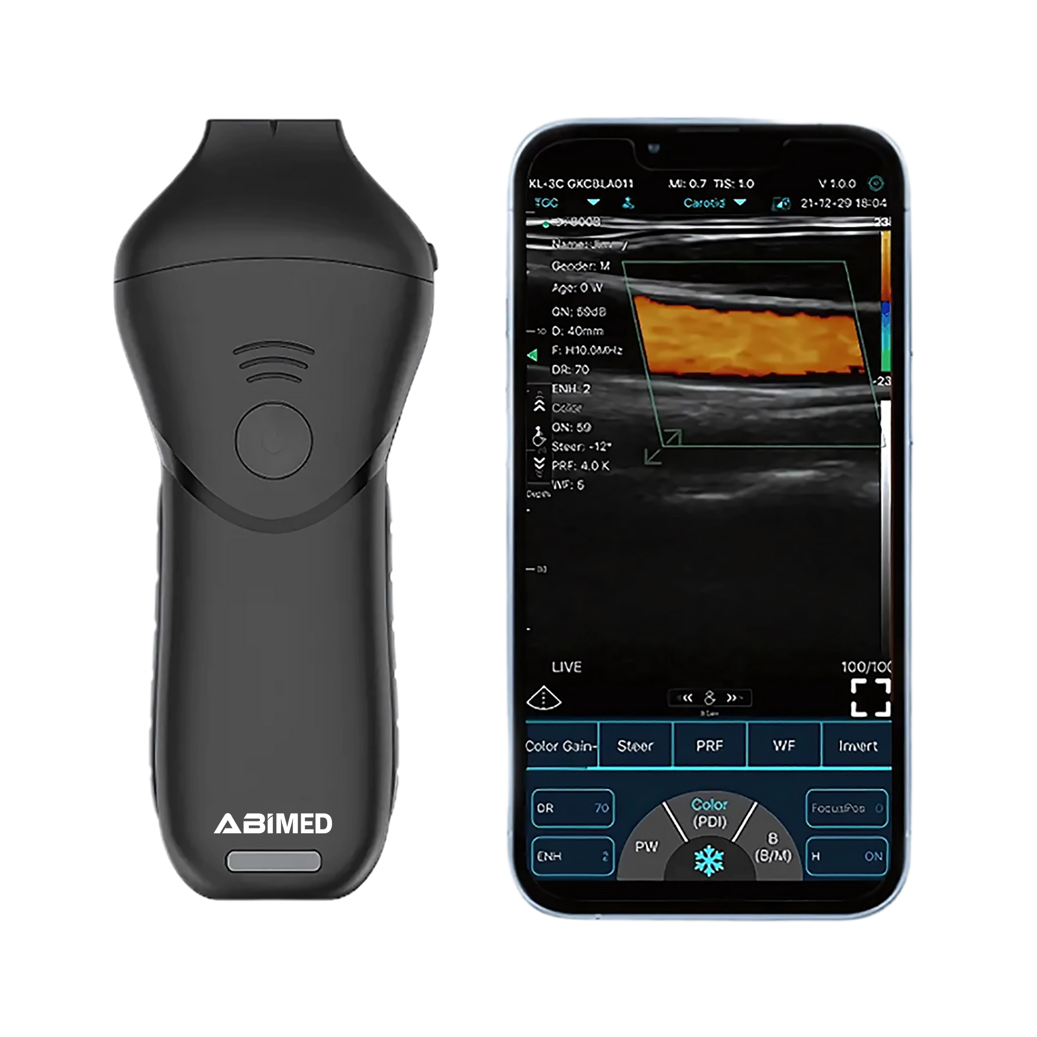 Ultrasound Scanner AM-USB13