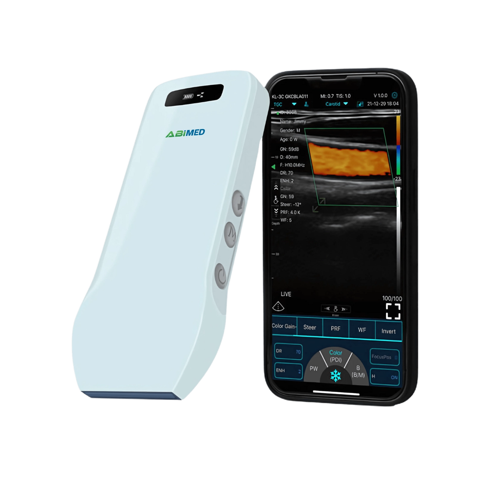 Ultrasound Scanner AM-USB20