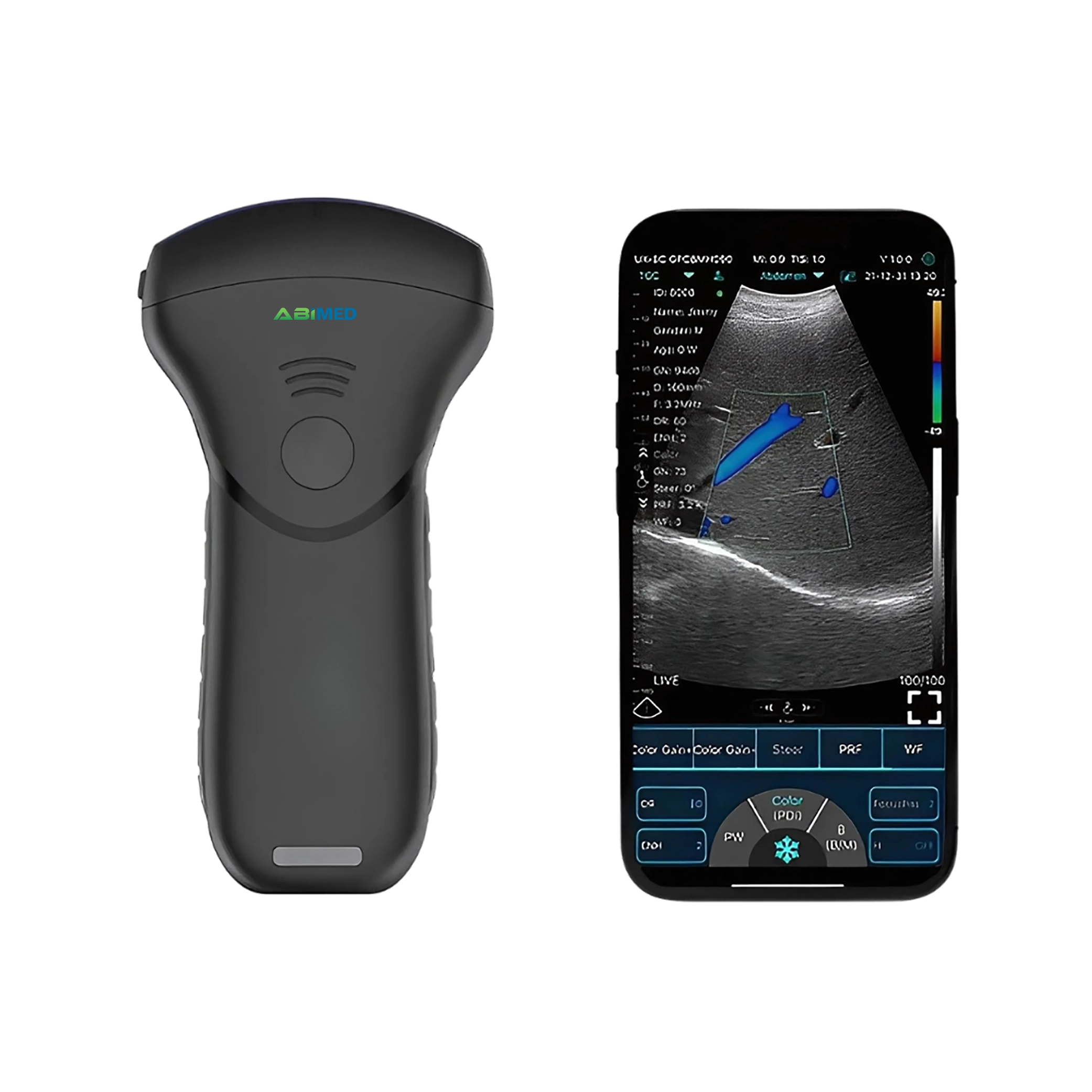 Ultrasound Scanner AM-USB21